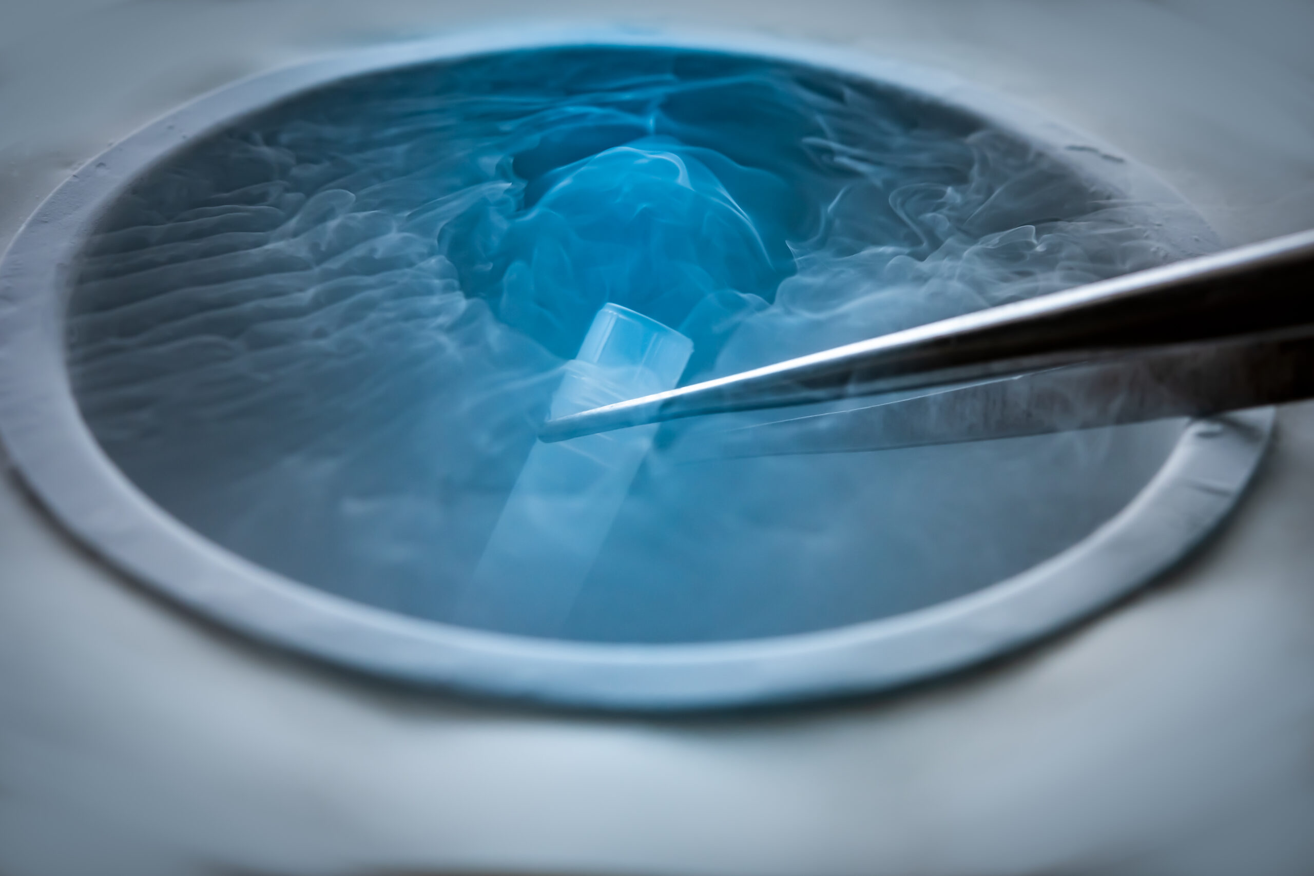 The Big Freeze: An Insight into the History of Cryopreservation